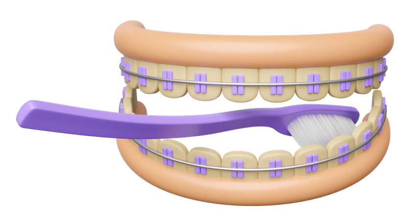 Tooth cleaning with teeth braces  3D Illustration