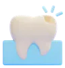 Tooth Decay