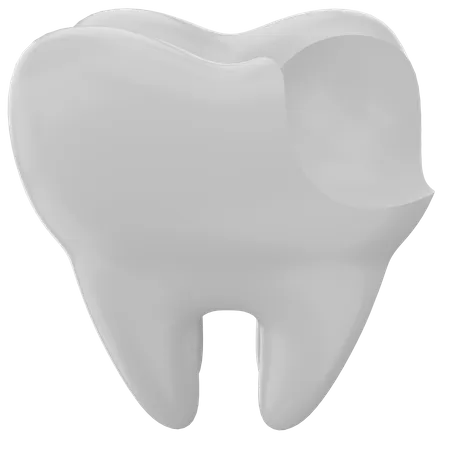 Tooth decay  3D Illustration