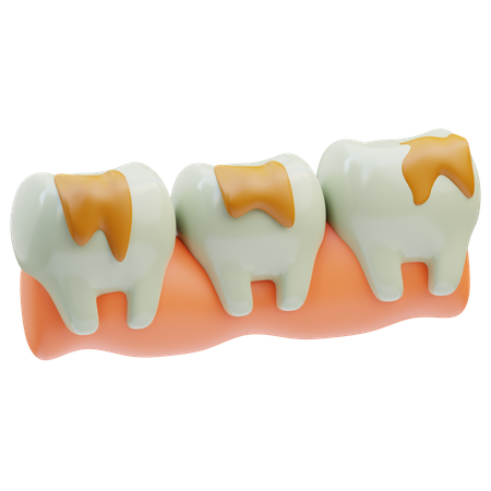 Tooth Decayed  3D Icon