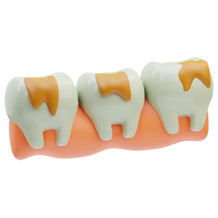 Tooth Decayed  3D Icon