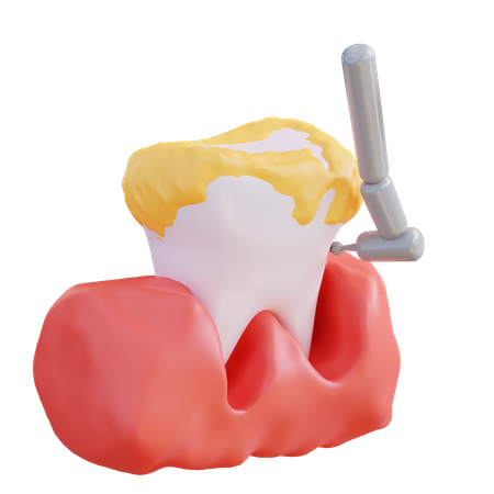 Tooth Drill  3D Icon