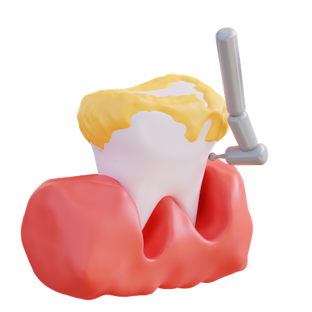 Tooth Drill  3D Icon