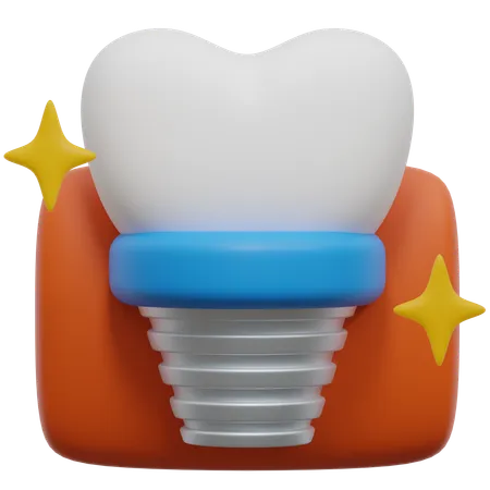 Tooth Implant From Dentist 3 D Icon 3D Icon