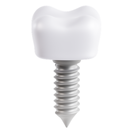 Tooth Implant  3D Icon