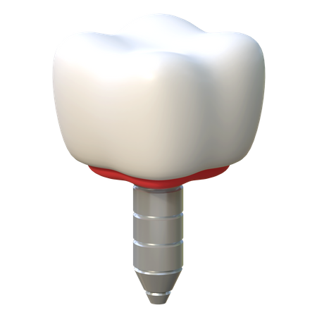 Tooth Implant  3D Icon