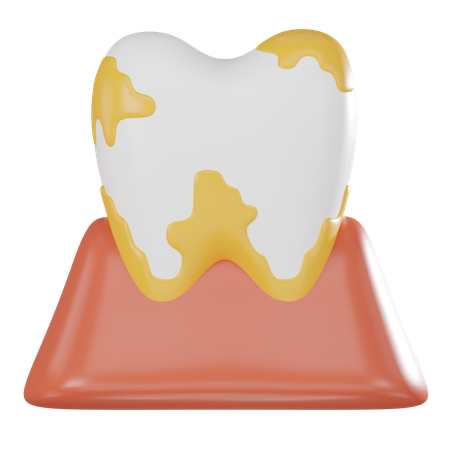 Tooth Plaque  3D Icon