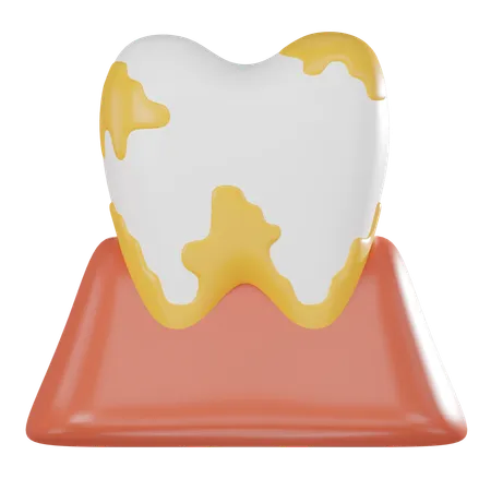 Tooth Plaque  3D Icon