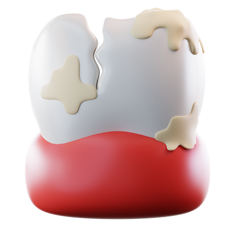 Tooth Plaque  3D Icon