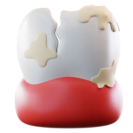 Tooth Plaque  3D Icon