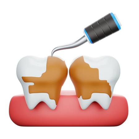 Tooth Scaling Treatment  3D Icon