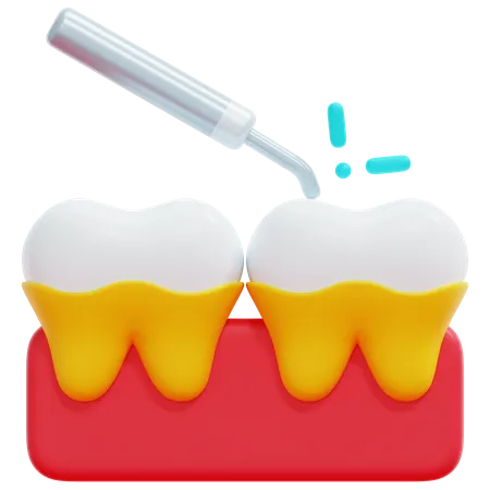 Tooth Scaling Treatment  3D Icon