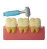 Tooth Scaling Treatment