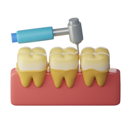 Tooth Scaling Treatment  3D Icon