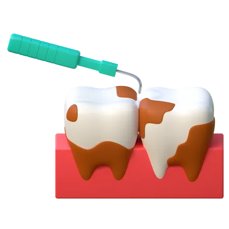 Tooth Plaque Scaling Icon Dental Care 3 D Illustration 3D Icon