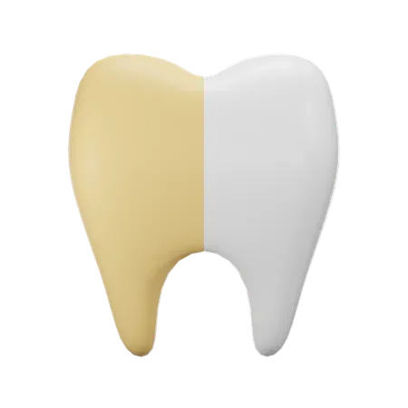 Tooth Whitening  3D Icon