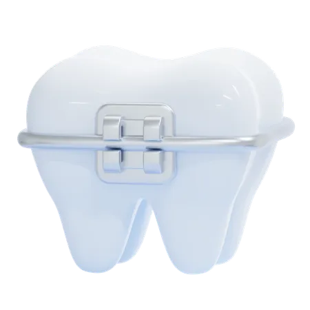 Tooth With Braces  3D Icon