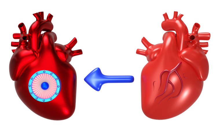 Transplantation cardiaque  3D Icon