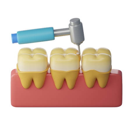 Tratamento de raspagem dentária  3D Icon