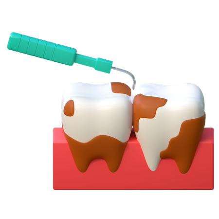 Tratamento de raspagem dentária  3D Icon