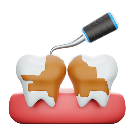 Tratamiento de raspado dental  3D Icon