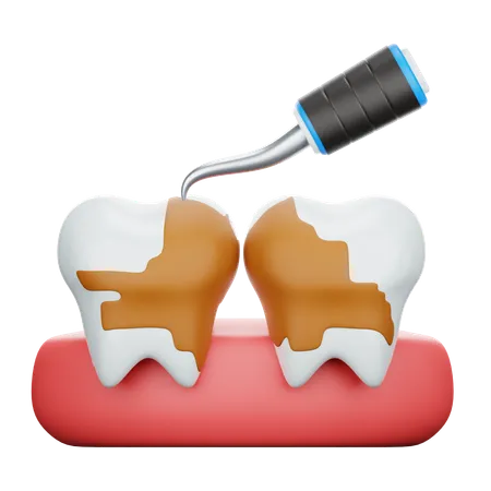 Tratamiento de raspado dental  3D Icon