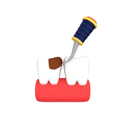 Tratamiento de raspado dental  3D Icon