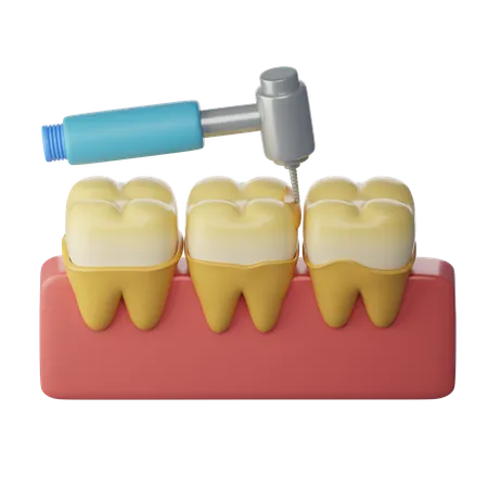 Tratamiento de raspado dental  3D Icon