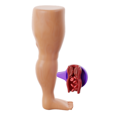 De la trombosis de la enfermedad cardíaca  3D Icon
