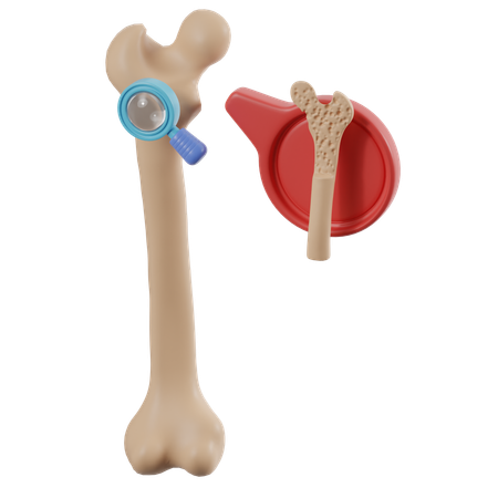 Überprüfung der Osteoporose der Knochen  3D Icon