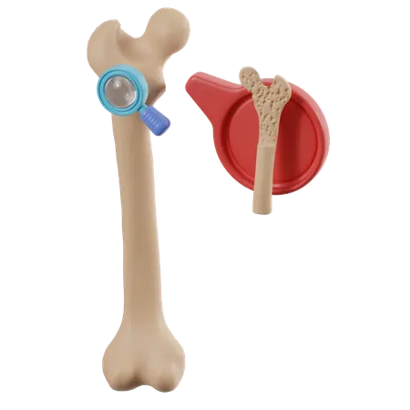 Überprüfung der Osteoporose der Knochen  3D Icon