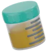 Urine