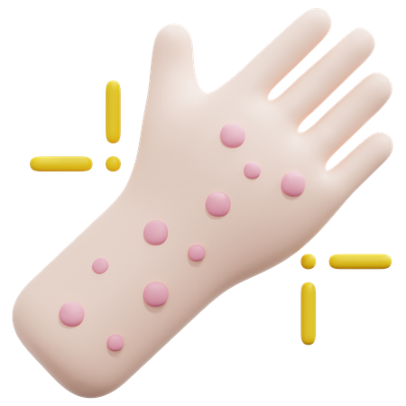 Urtikaria  3D Icon