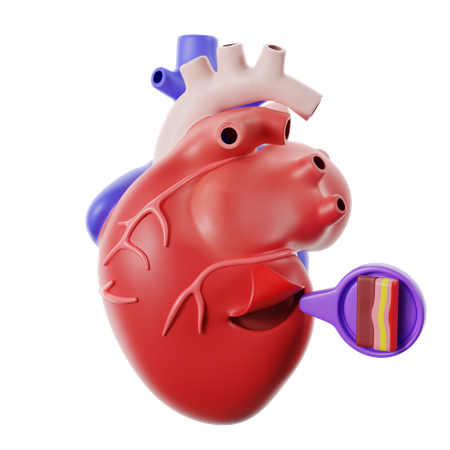 Der Herzkrankheit Perikarditis  3D Icon