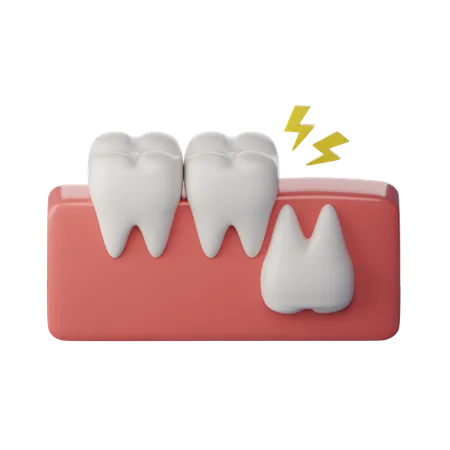 Weisheitszahn umgedreht  3D Icon