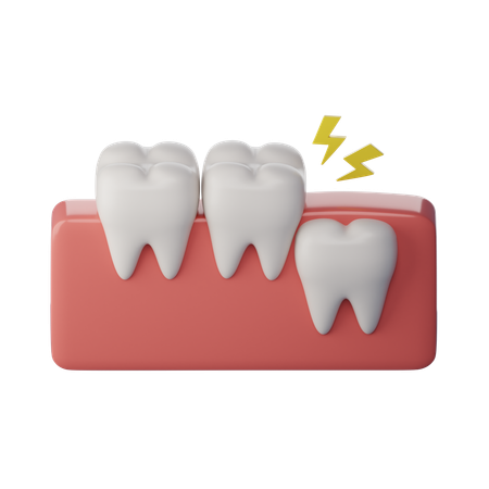 Weisheitszahn vertikal  3D Icon