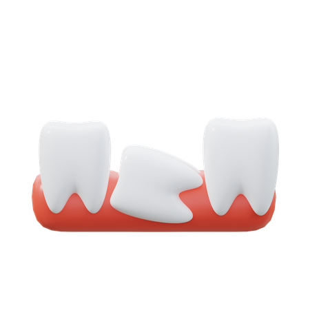 Wisdom Teeth  3D Icon