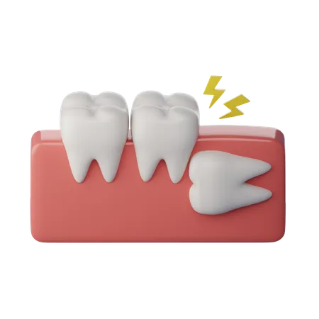 Wisdom Tooth Horizontal  3D Icon