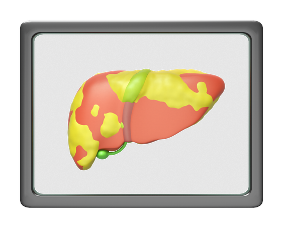 X Ray Film Liver  3D Icon