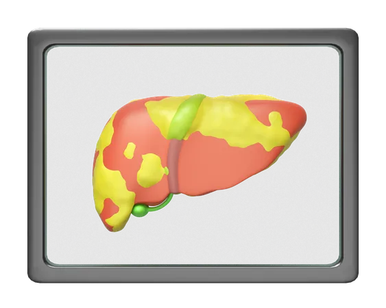 X Ray Film Liver  3D Icon