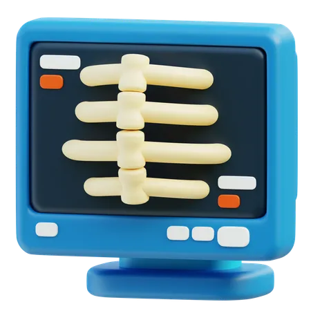 A 3 D Illustration Of A Digital X Ray Monitor Displaying A Detailed View Of The Spine Encased In A Blue Frame 3D Icon