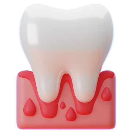 Zahnfleischentzündung  3D Icon