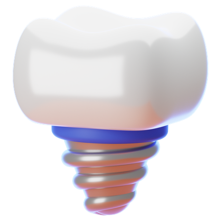 Zahnimplantat  3D Icon