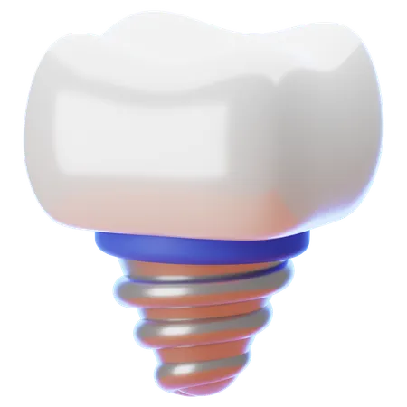 Zahnimplantat  3D Icon