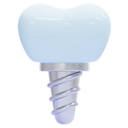 Zahnimplantat  3D Icon
