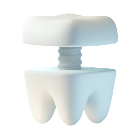 Zahnimplantat  3D Icon