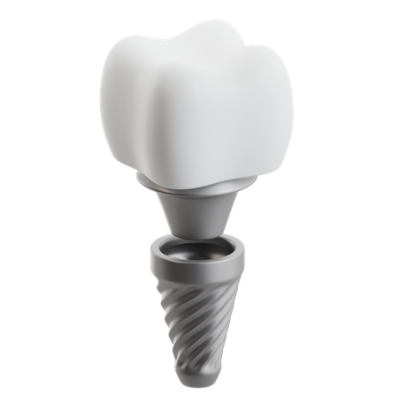Zahnimplantatschraube  3D Icon