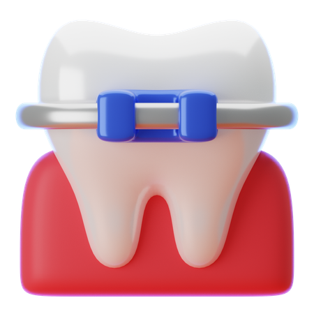 Zahnspangen  3D Icon