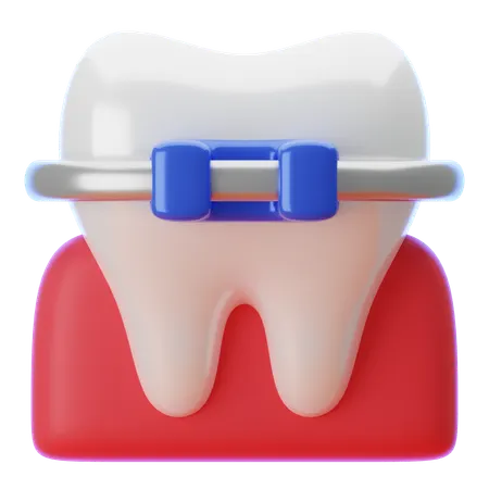 Zahnspangen  3D Icon